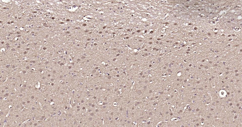 3-磷酸甘油醛脱氢酶(内参)抗体