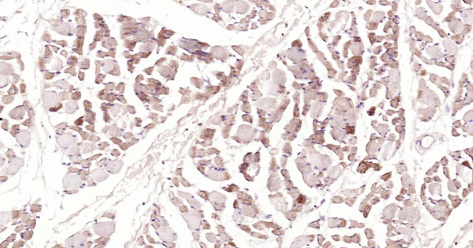 凋亡诱导因子重组兔单抗