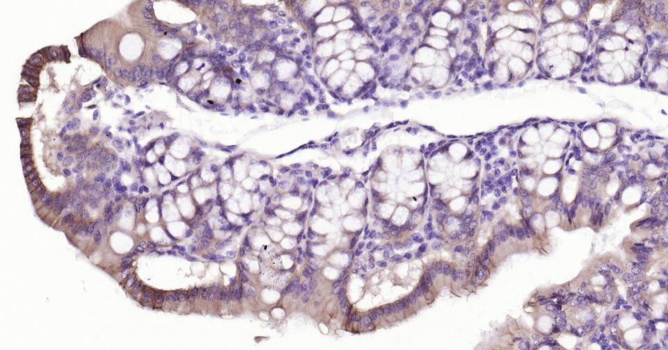 上皮钙粘附分子重组兔单抗
