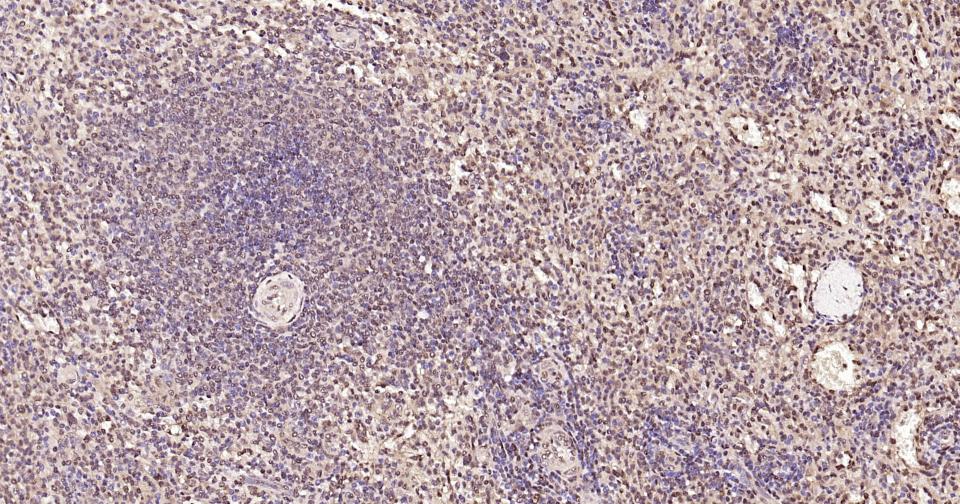 3-磷酸甘油醛脱氢酶(内参)抗体