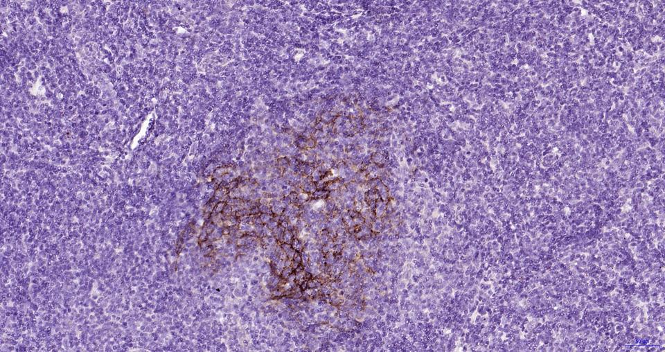 人CD23单克隆抗体-bsm-30109M