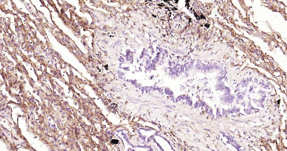 细胞间粘附分子-1(CD54)重组兔单抗
