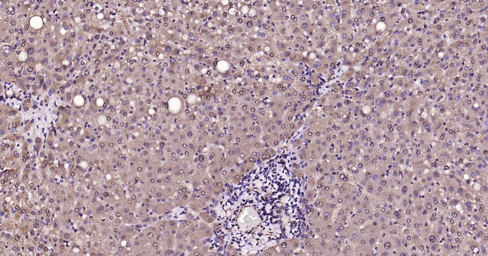 3-磷酸甘油醛脱氢酶(内参)重组兔单抗