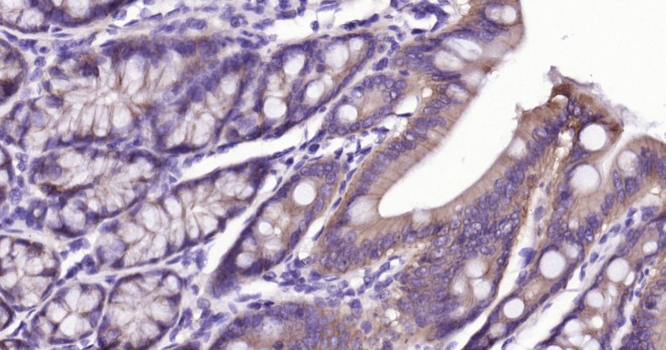 上皮钙粘附分子重组兔单抗