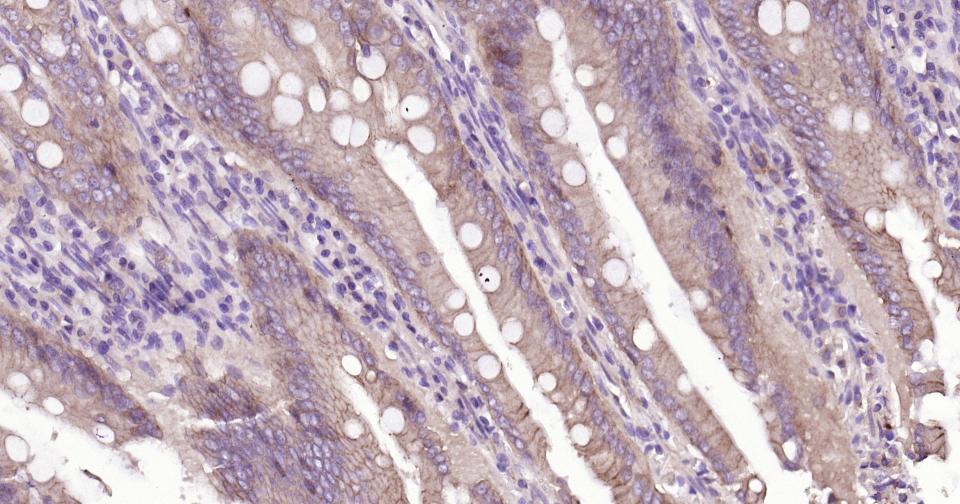 上皮钙粘附分子重组兔单抗
