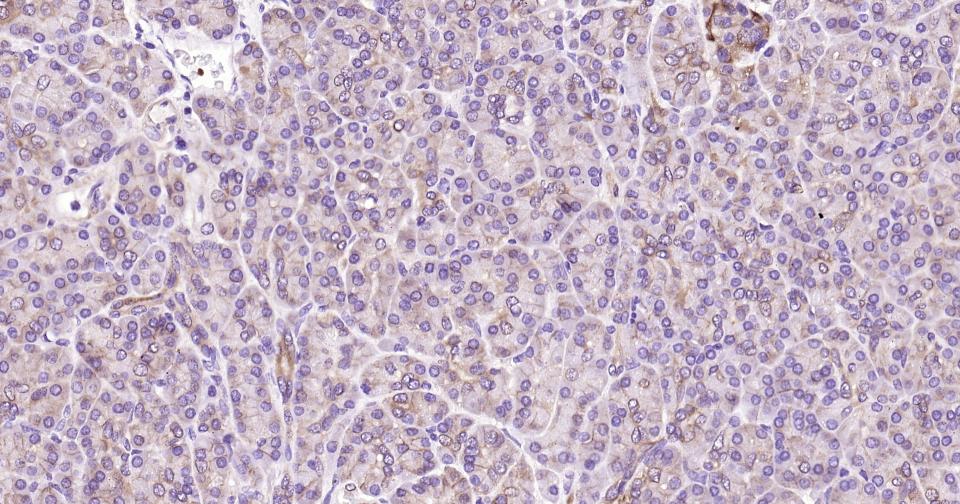 上皮钙粘附分子重组兔单抗
