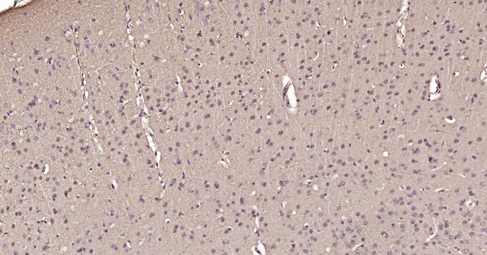 3-磷酸甘油醛脱氢酶(内参)抗体