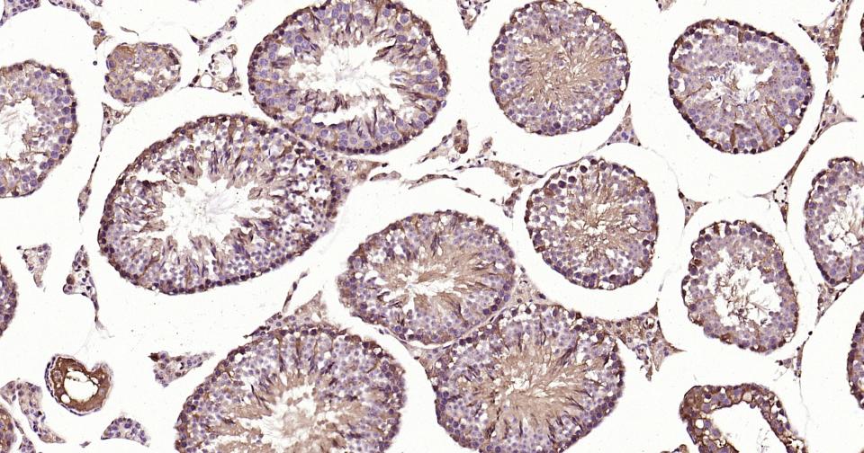 3-磷酸甘油醛脱氢酶(内参)抗体