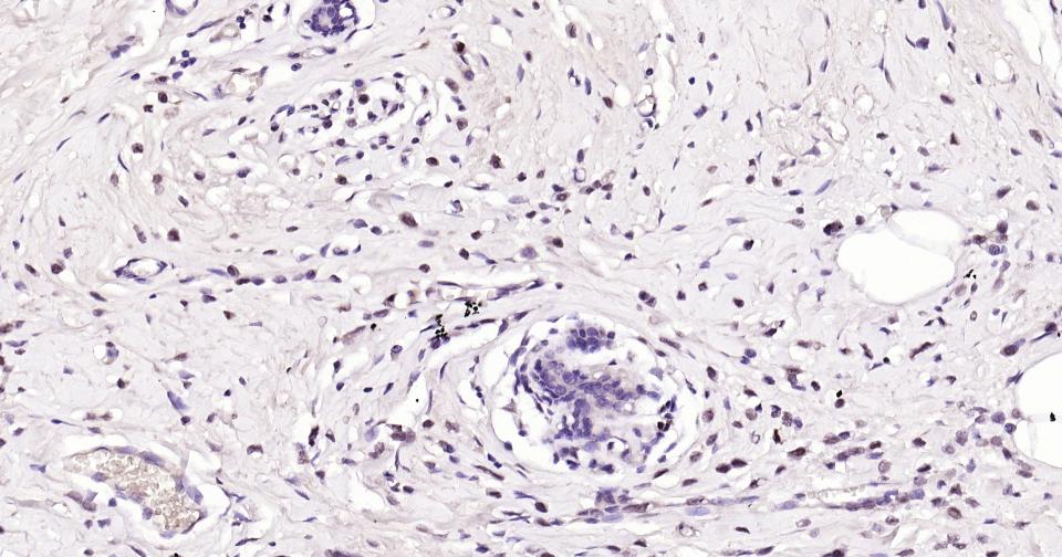 多腺苷二磷酸多聚酶重组兔单抗
