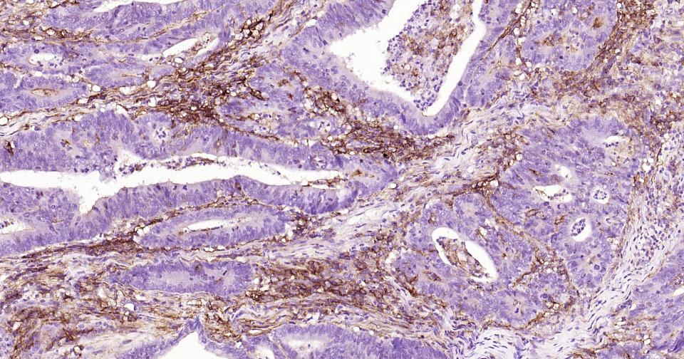 细胞间粘附分子-1(CD54)重组兔单抗