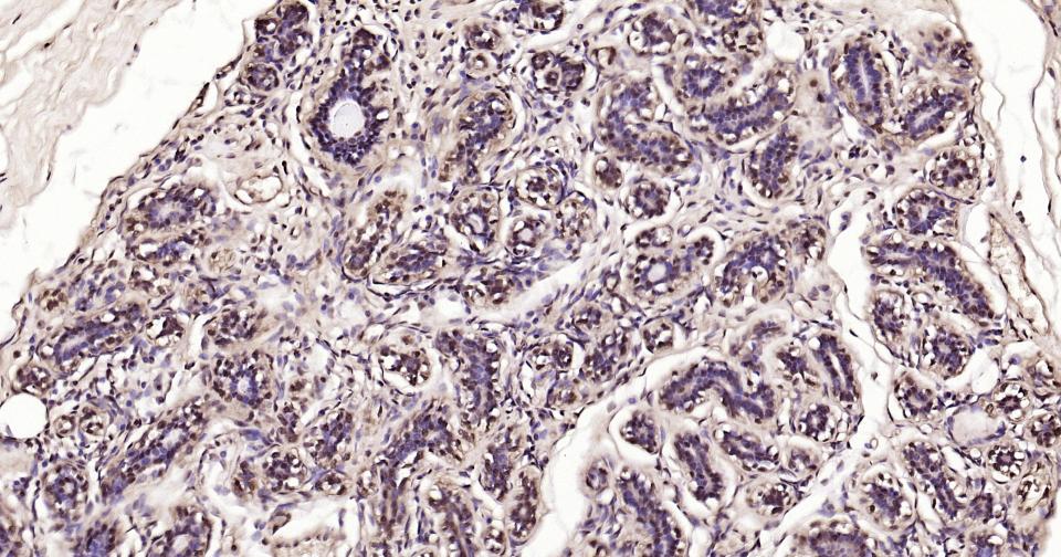 3-磷酸甘油醛脱氢酶(内参)抗体