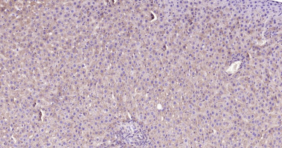 上皮钙粘附分子重组兔单抗