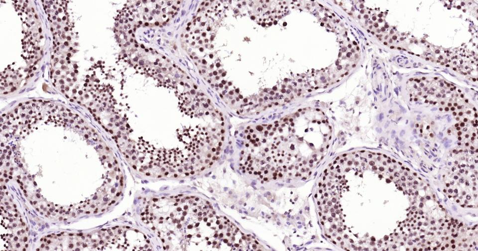 多腺苷二磷酸多聚酶重组兔单抗