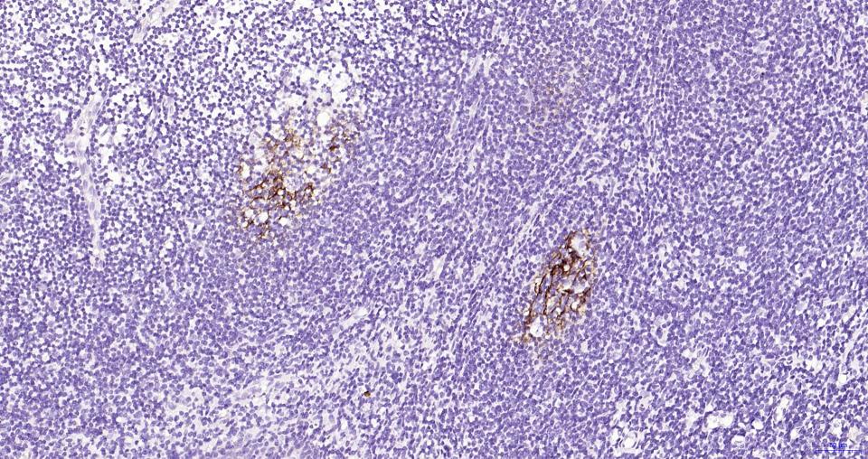 human CD23 Mouse mAb (一抗) | Bioss