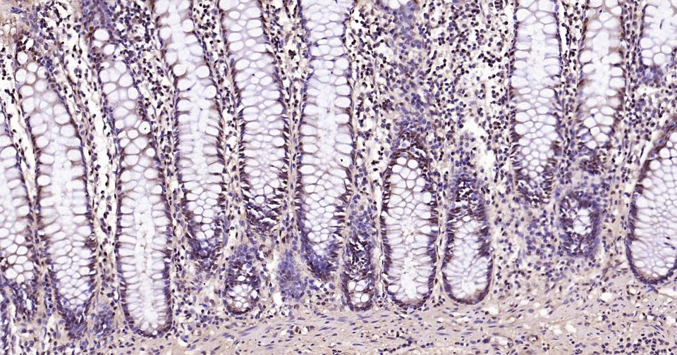 3-磷酸甘油醛脱氢酶(内参)抗体