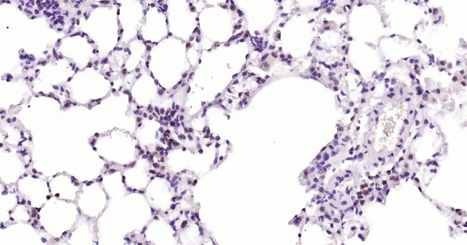 多腺苷二磷酸多聚酶重组兔单抗