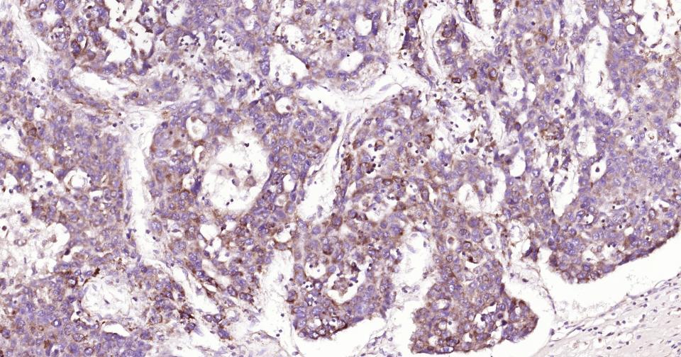 凋亡诱导因子重组兔单抗