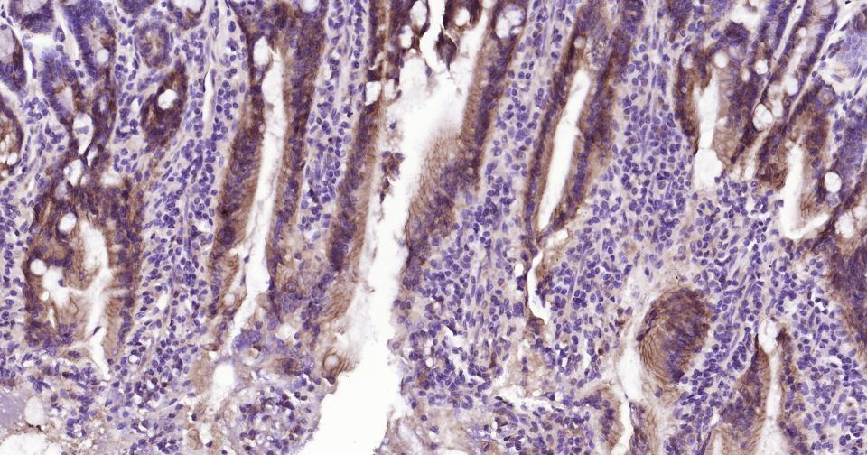 上皮钙粘附分子重组兔单抗