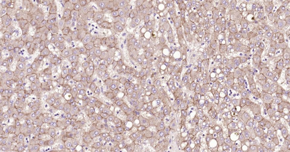 上皮钙粘附分子重组兔单抗