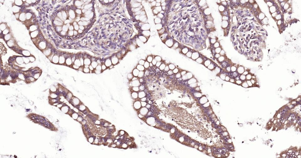 上皮钙粘附分子重组兔单抗