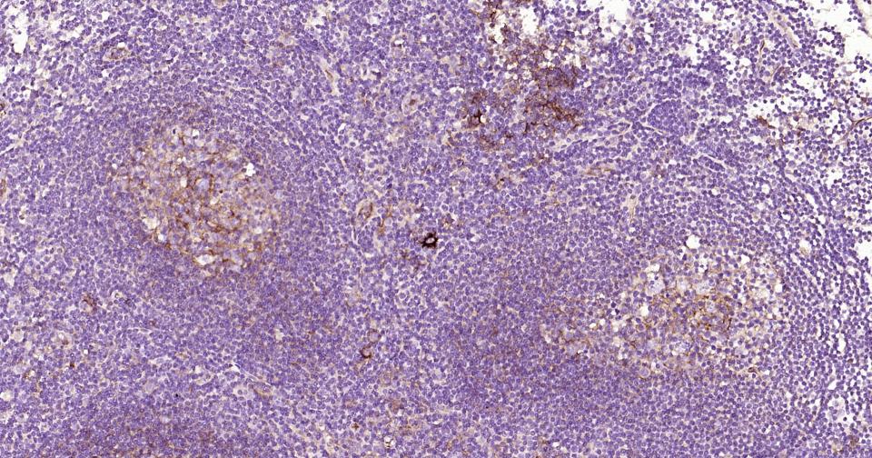 细胞间粘附分子-1(CD54)重组兔单抗