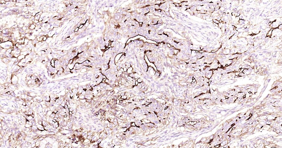 细胞间粘附分子-1(CD54)重组兔单抗