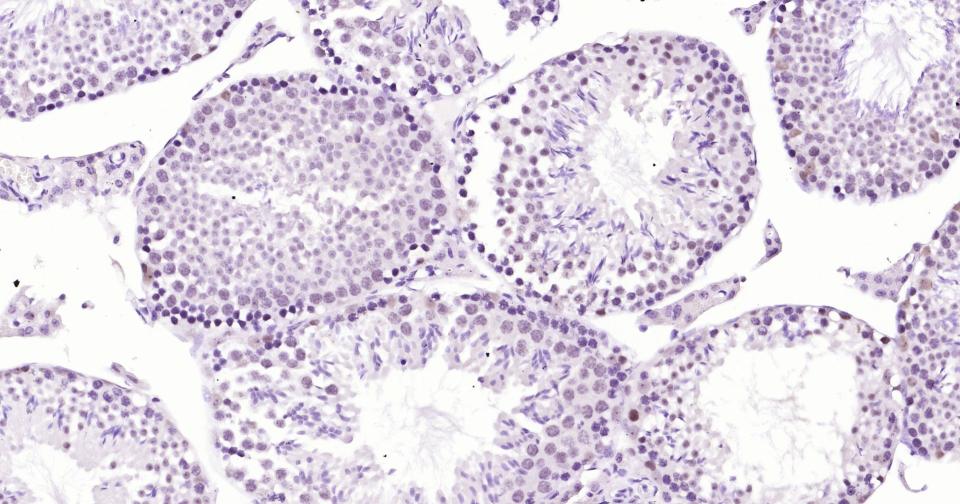 多腺苷二磷酸多聚酶重组兔单抗