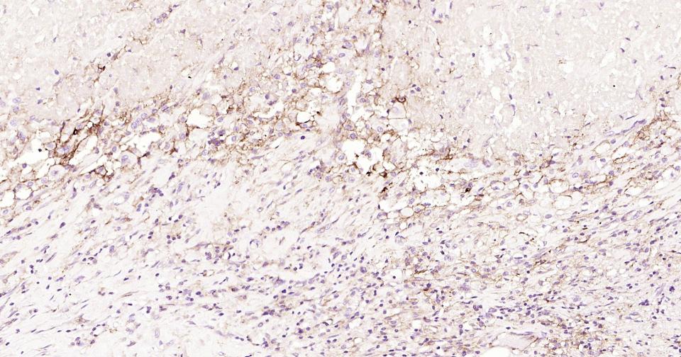 细胞间粘附分子-1(CD54)重组兔单抗