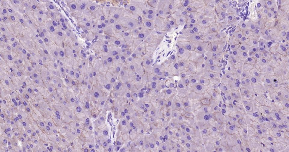 上皮钙粘附分子重组兔单抗