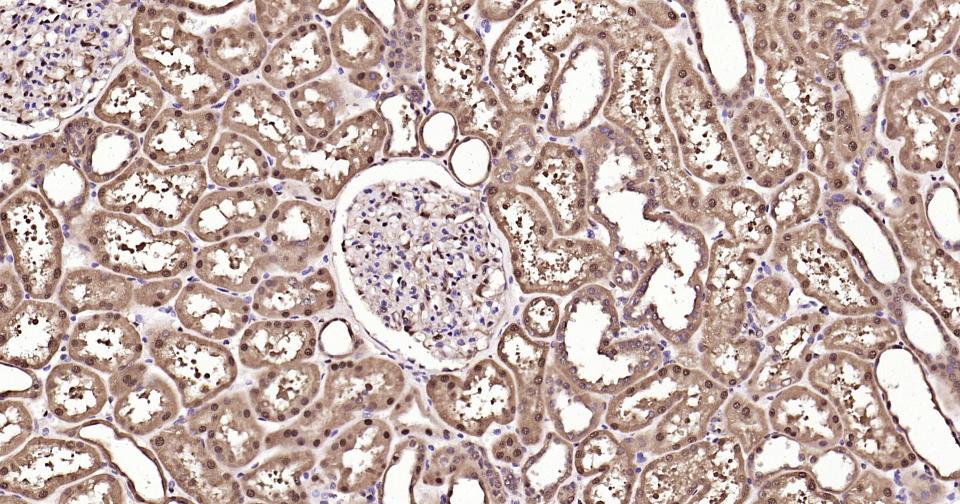 3-磷酸甘油醛脱氢酶(内参)抗体