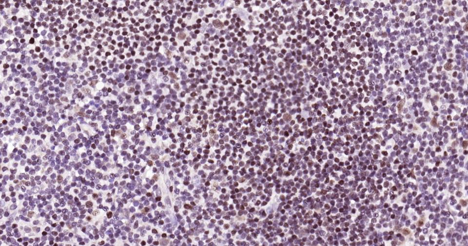 多腺苷二磷酸多聚酶重组兔单抗