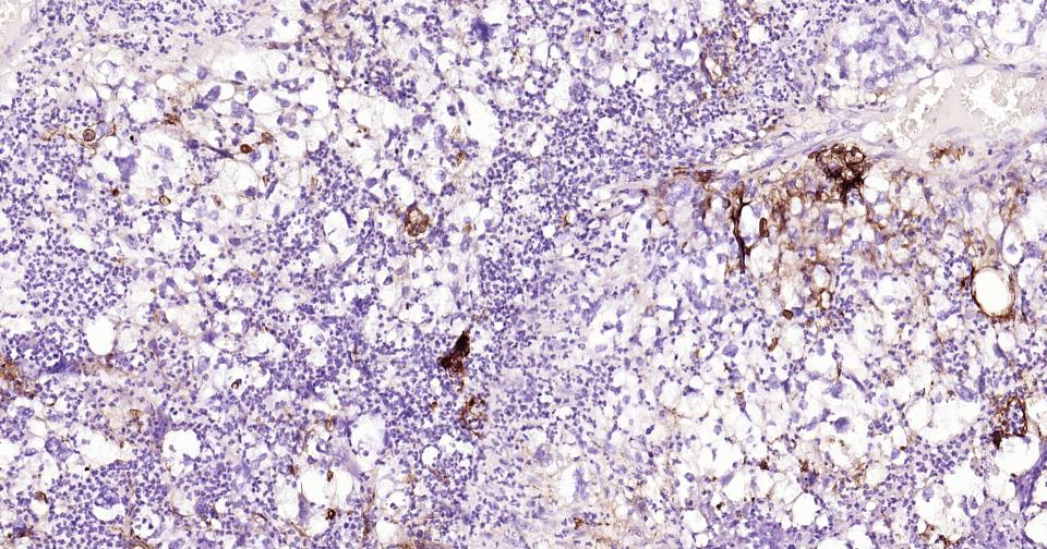 细胞间粘附分子-1(CD54)重组兔单抗