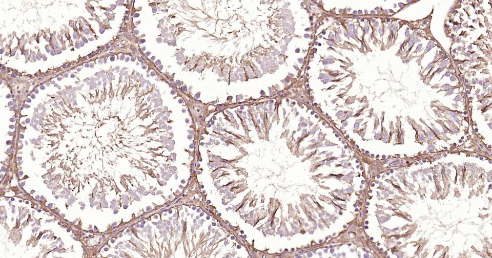 3-磷酸甘油醛脱氢酶(内参)抗体