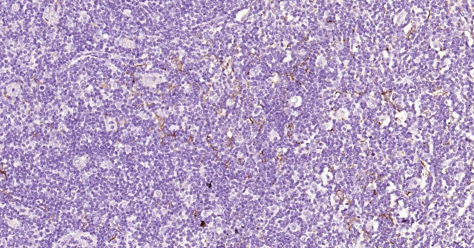 CD163重组兔单抗