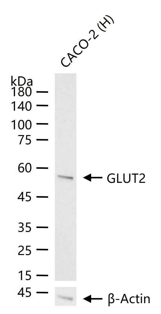 葡萄糖转运蛋白2重组兔单抗