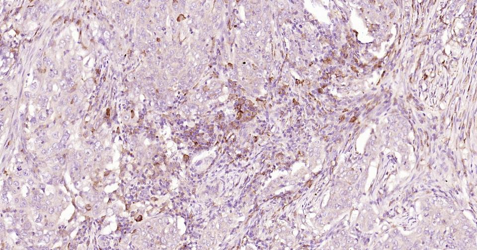 CD163重组兔单抗