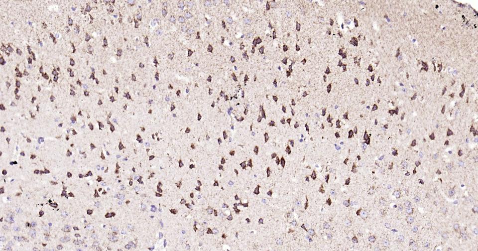 热休克蛋白-60/groEL重组兔单抗