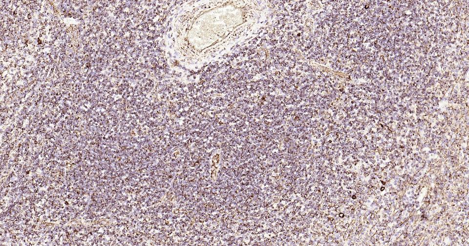 热休克蛋白-60/groEL重组兔单抗