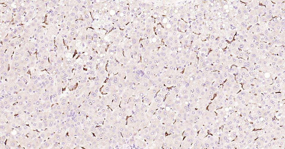 CD163重组兔单抗