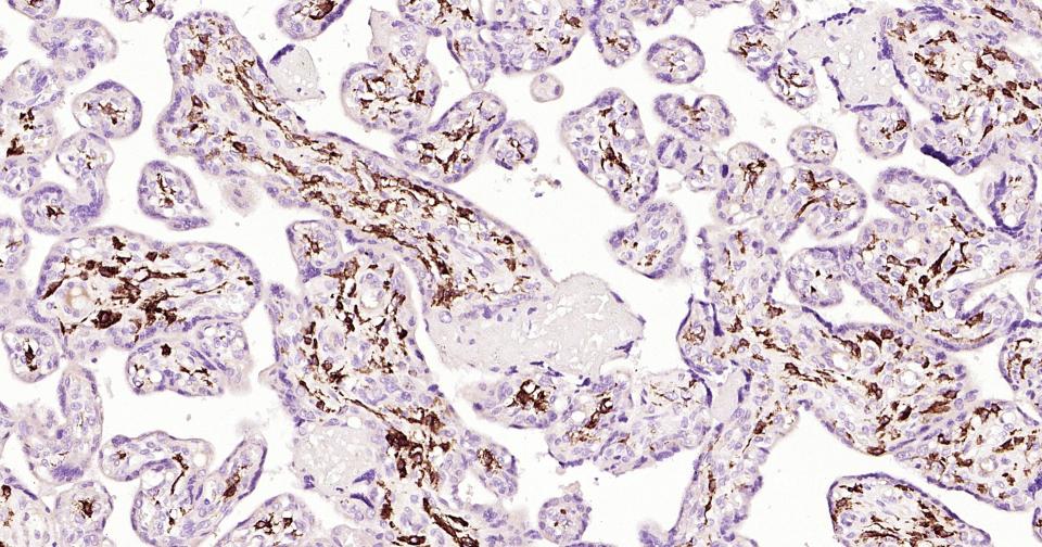 CD163重组兔单抗