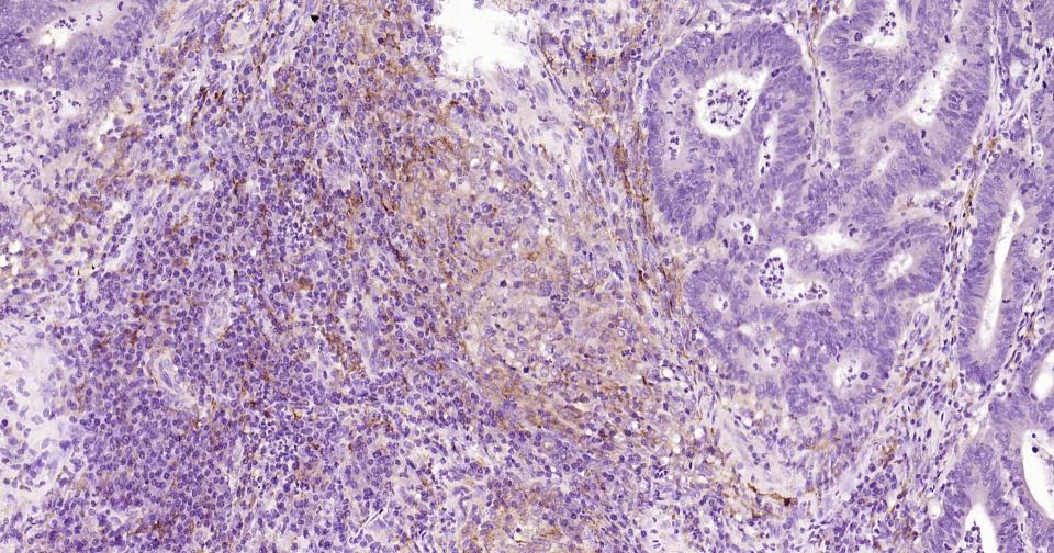 CD163重组兔单抗