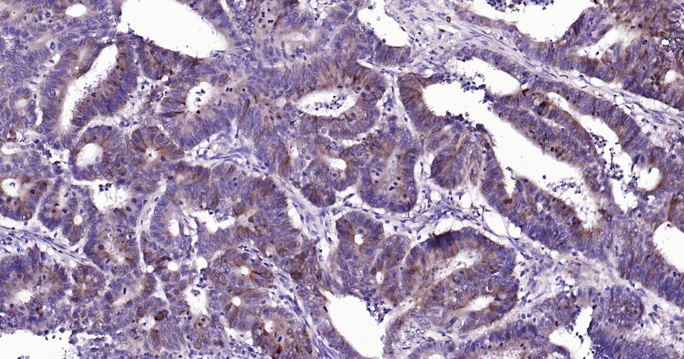 Caspase-9重组兔单抗