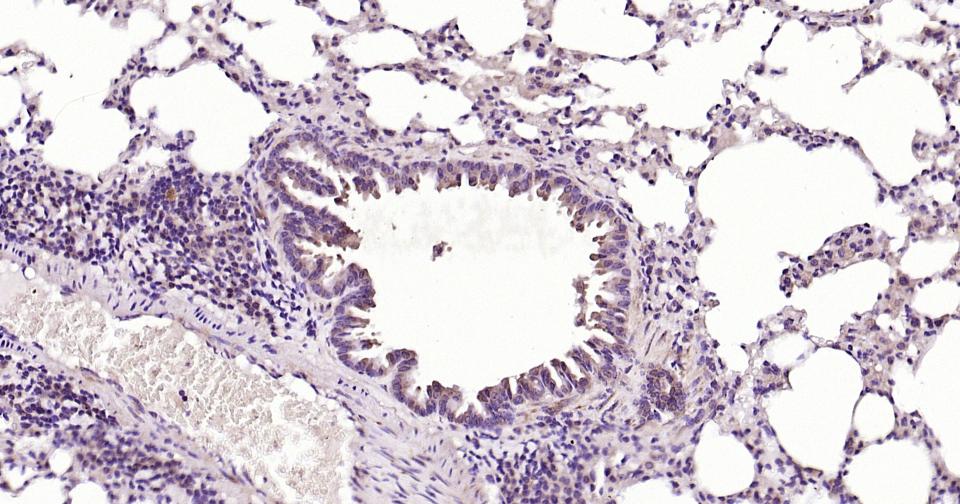 Caspase-9重组兔单抗