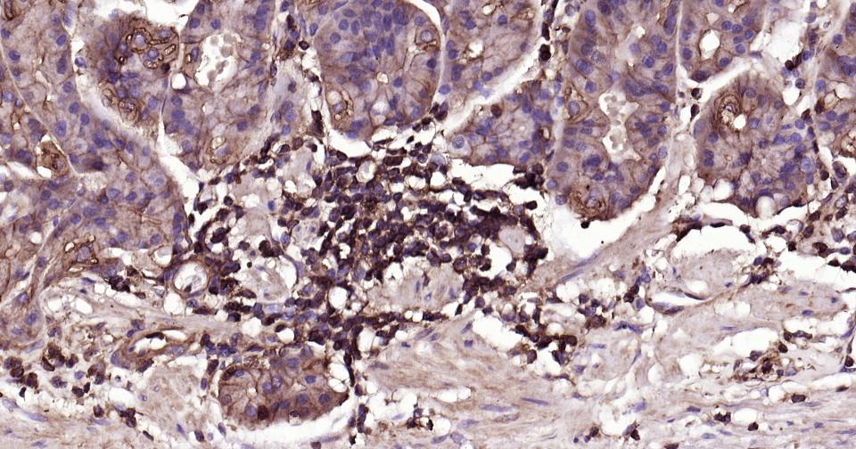 巨噬细胞甘露糖受体 (CD206) 重组兔单抗