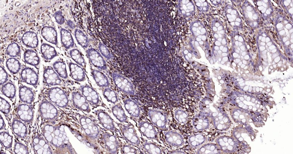 巨噬细胞甘露糖受体 (CD206) 重组兔单抗