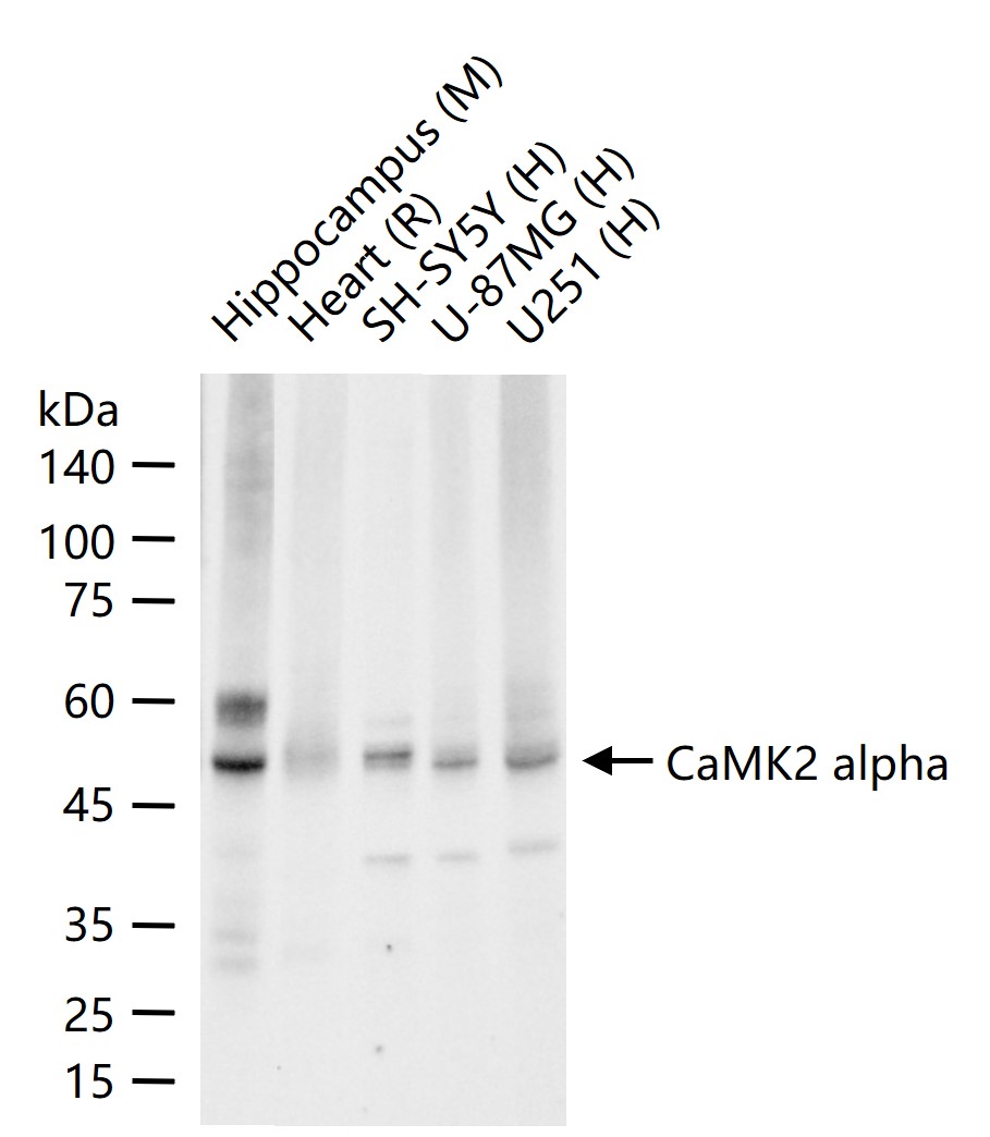 钙/钙调素依赖蛋白激酶2α重组兔单抗