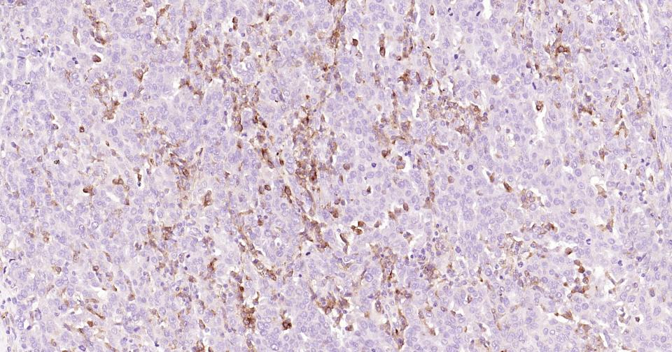 CD163重组兔单抗