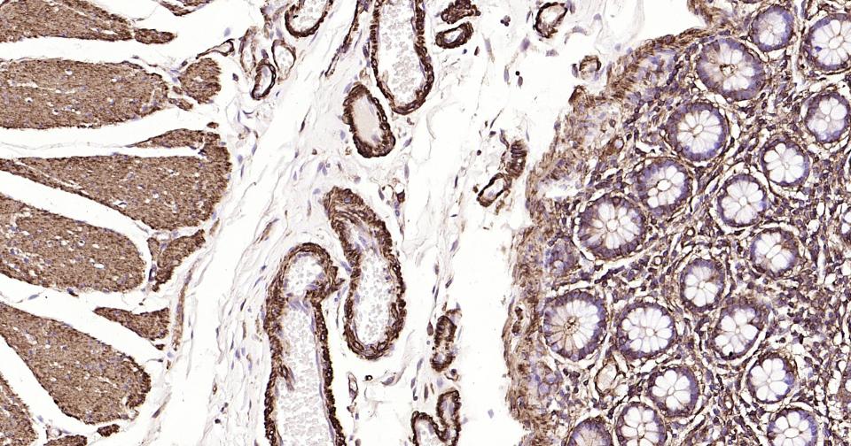 α-SMA重组兔单抗