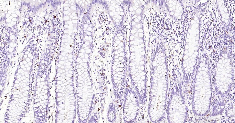 原癌基因蛋白c-kit(CD117)重组兔单抗