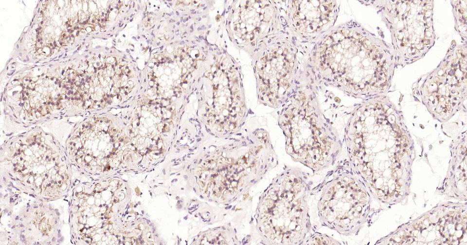 线粒体促凋亡蛋白重组兔单抗